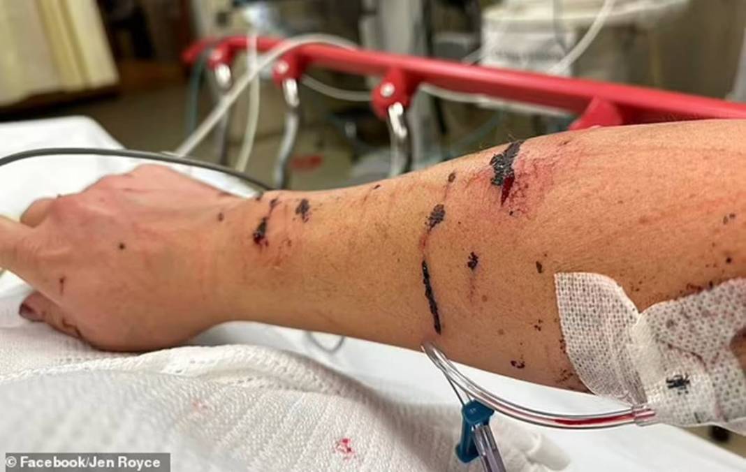 Nehre girdi, kanlar içinde çıktı! O canavar yüzünü paramparça etti... Arkasından usulca gelip... 6